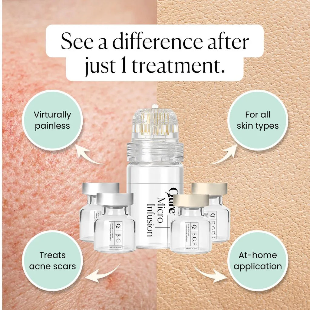 Qure Micro-Infusion Ad – Skincare Device for Scar & Pore Repair (Before/After Visual)